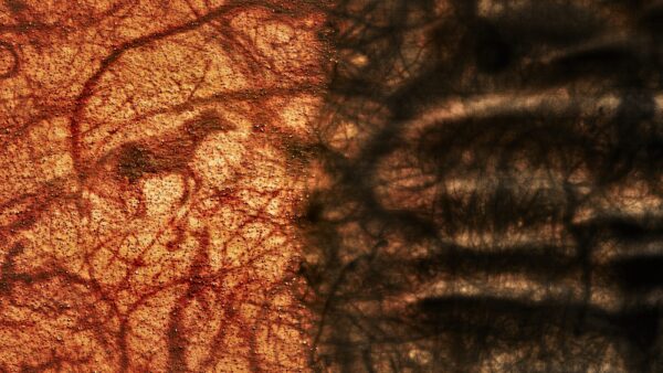 A close up of the skin on a person 's face.