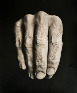 A hand with wrinkled skin is shown in this image.