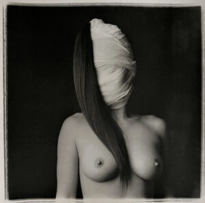 A woman with a bandage covering her face.