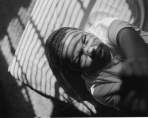 A black and white photo of a person with a bandage on their head.