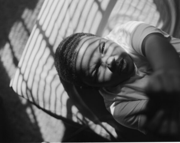 A black and white photo of a person with a bandage on their head.